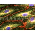 Human Tumor-Associated Endothelial Cells